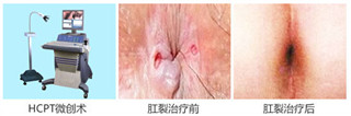 阜阳兆岐肛肠医院
