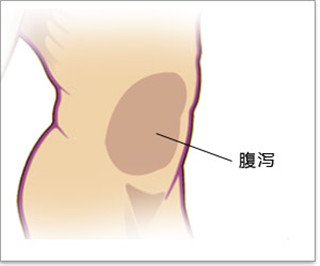 阜阳兆岐肛肠医院